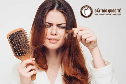 5 nguyên nhân rụng tóc kinh hoàng ai cũng đều gặp phải
