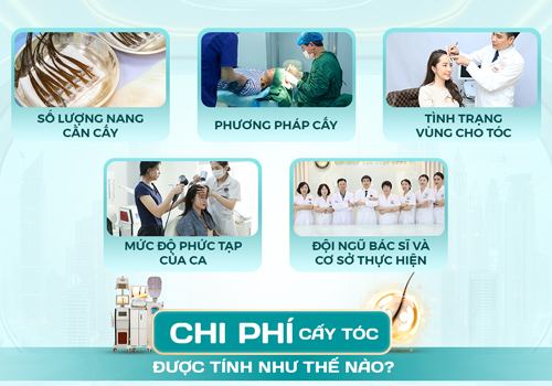Chi phí cấy tóc bao nhiêu? Bảng giá chi tiết 2026