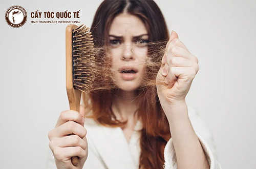 Hỏi – Đáp: Rụng tóc phải làm sao? Chia Sẻ Từ Chuyên Gia Chăm Sóc Tóc