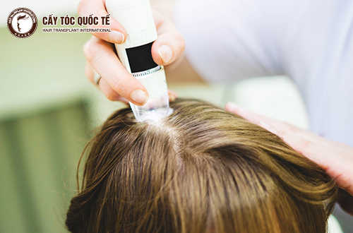 Tìm hiểu về tóc gãy rụng và cách điều trị “chuẩn” như chuyên gia