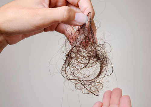 Bất ngờ với 5 nguyên nhân hàng đầu gây rụng tóc bất thường