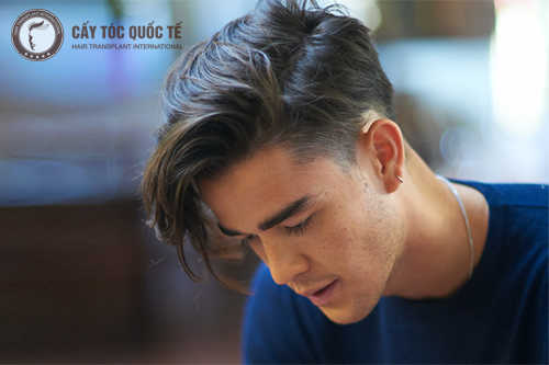 Địa chỉ cấy tóc mai uy tín nhất tại Hà Nội