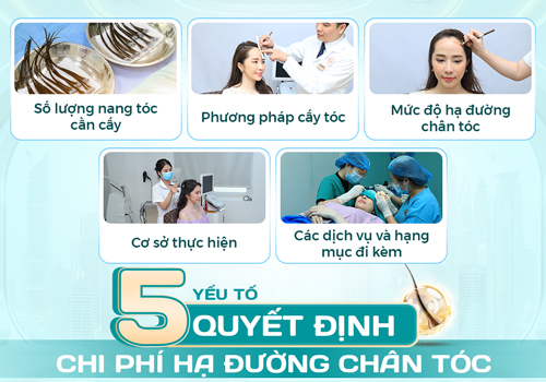 Hạ đường chân tóc bao nhiêu tiền? Bảng giá và những điều cần biết